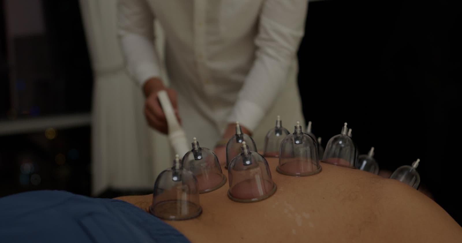 Cupping Therapy Session
